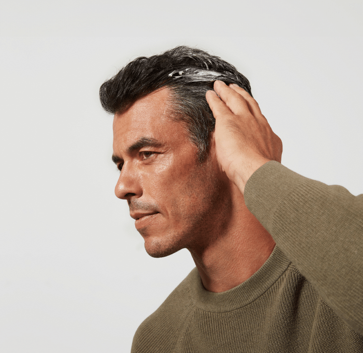 Hair Loss - Quiz 1 hairloss