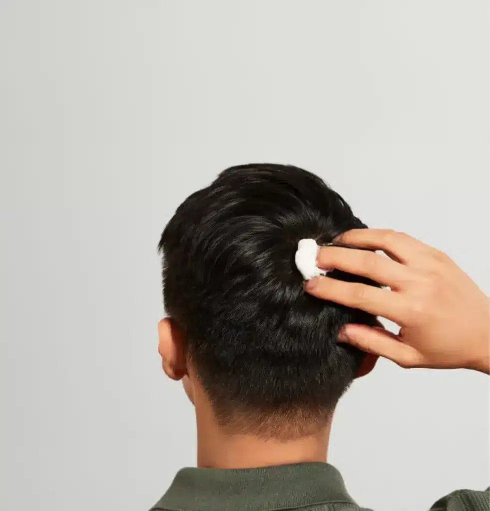 Hair Loss 2 Medically-backed solutions
